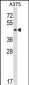 SUGT1 Antibody (C-term)